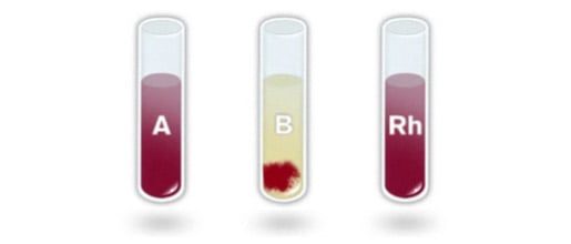 Rh factor blood test