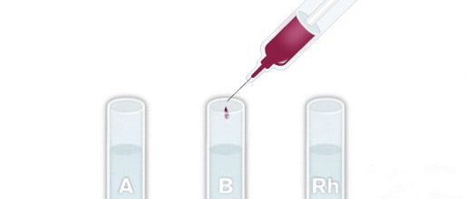 File:Blood typing by gel card method (column agglutination or MTS gel) -  type O positive.jpg - Wikipedia