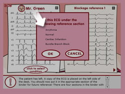 Help - the Electrocardiogram Game