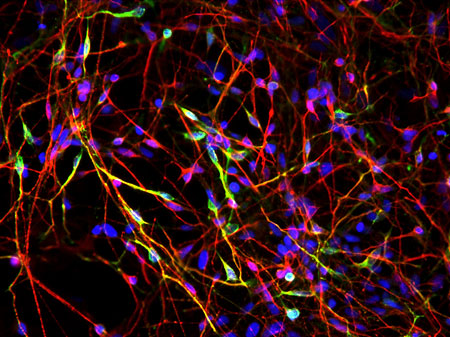 Nerve networks